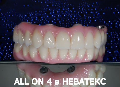 олл он фо протез верх и низ олл он фо протез верх и низ